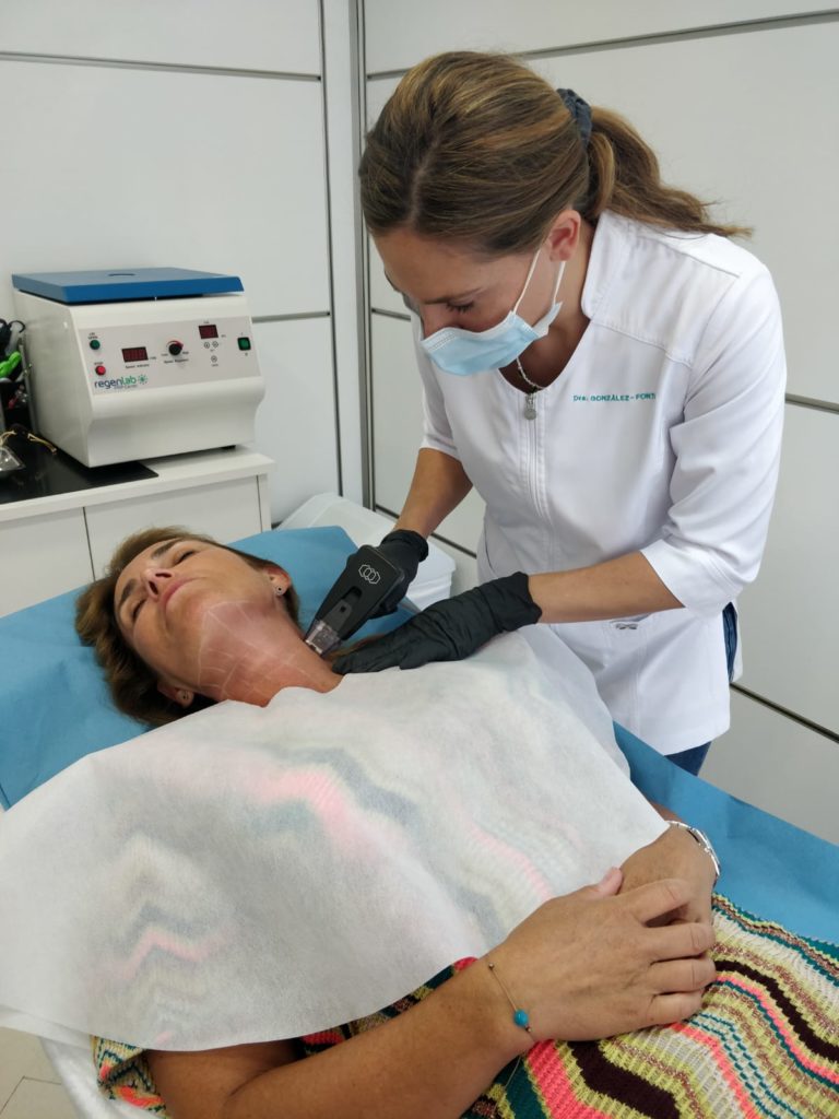 La Dra. González Fontana realizando un tratamiento para la papada con Morpheus 8